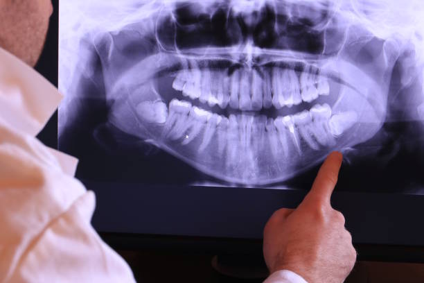 Best Walk-In Emergency Dentist in Rolesville, NC